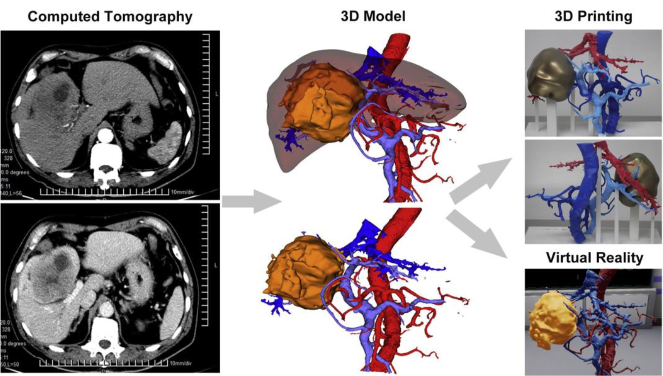 3D image